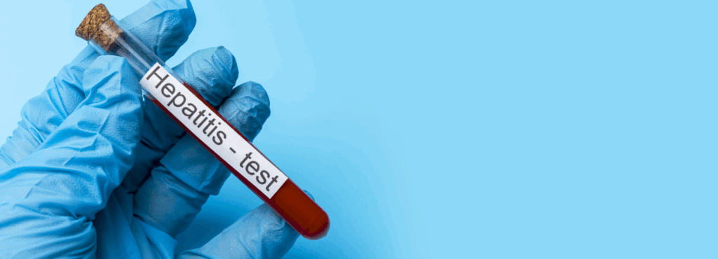 Virová hepatitida A – aktuální informace a prevence 1 Text odstavce 12